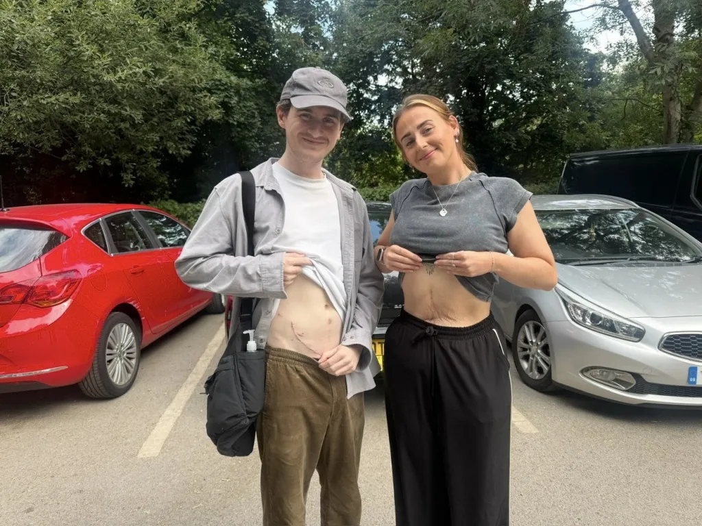 Rachel and Harry Ware showing their scars.