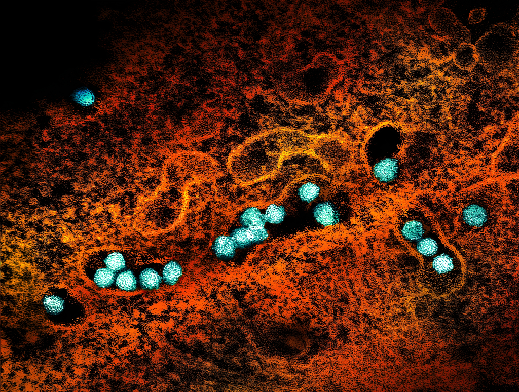Transmission electron micrograph of West Nile virus particles (teal) replicating within the cytoplasm of an infected VERO E6 cell (brown).
