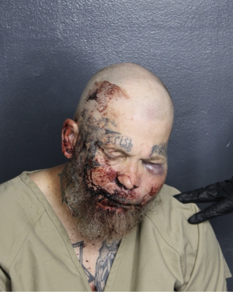 Ronald Jeffery Johnson sports his bloodied, swollen face in his mugshot after he attacked a police officer in a Florida hospital on Aug. 29, 2026.