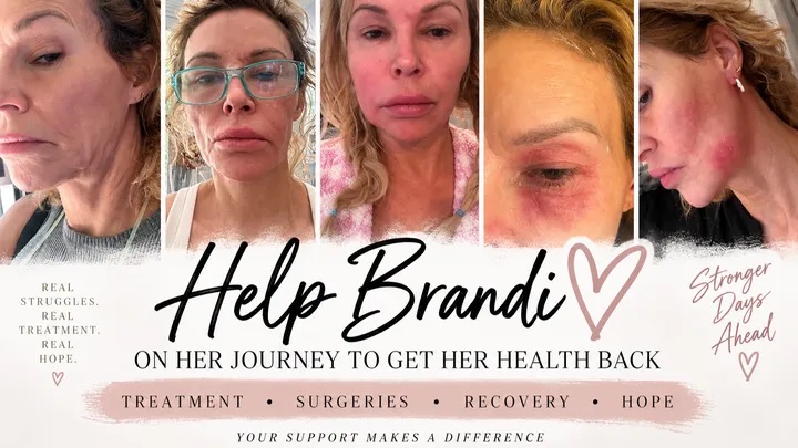 Collage of Brandi Glanville's face in various stages of distress and healing, with text 