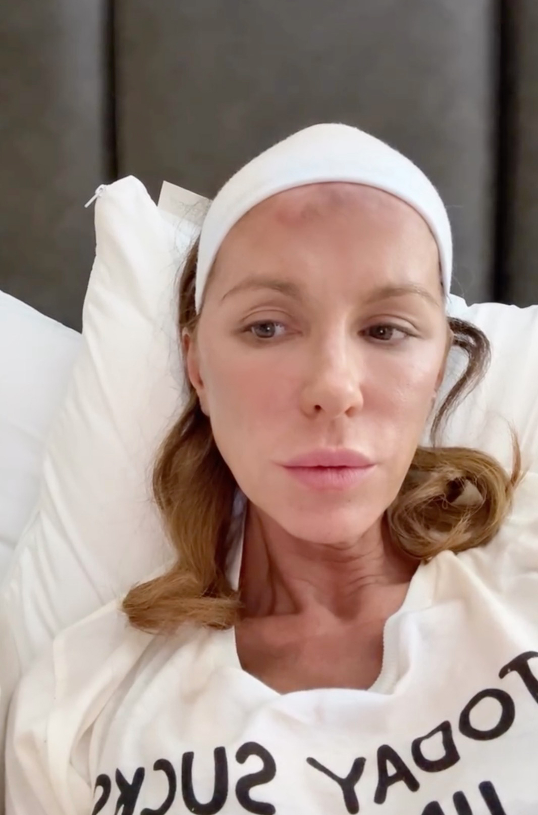 Kate Beckinsale lying in bed with a white headband and a bruise on her forehead.