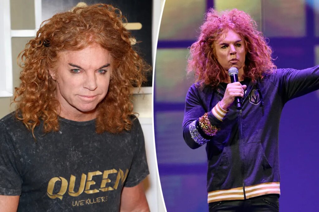 Carrot Top breaks silence after suicide attempt: ‘Overwhelmed by the outpouring of love’