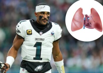 What is pulmonary embolism? The serious blood clot condition sidelining Jalen Hurts