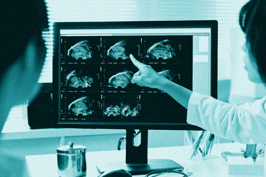 Why don’t more women know about fallopian tube removal?