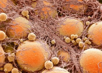 Scientists uncover a clue that could hint at why we regain weight after diets