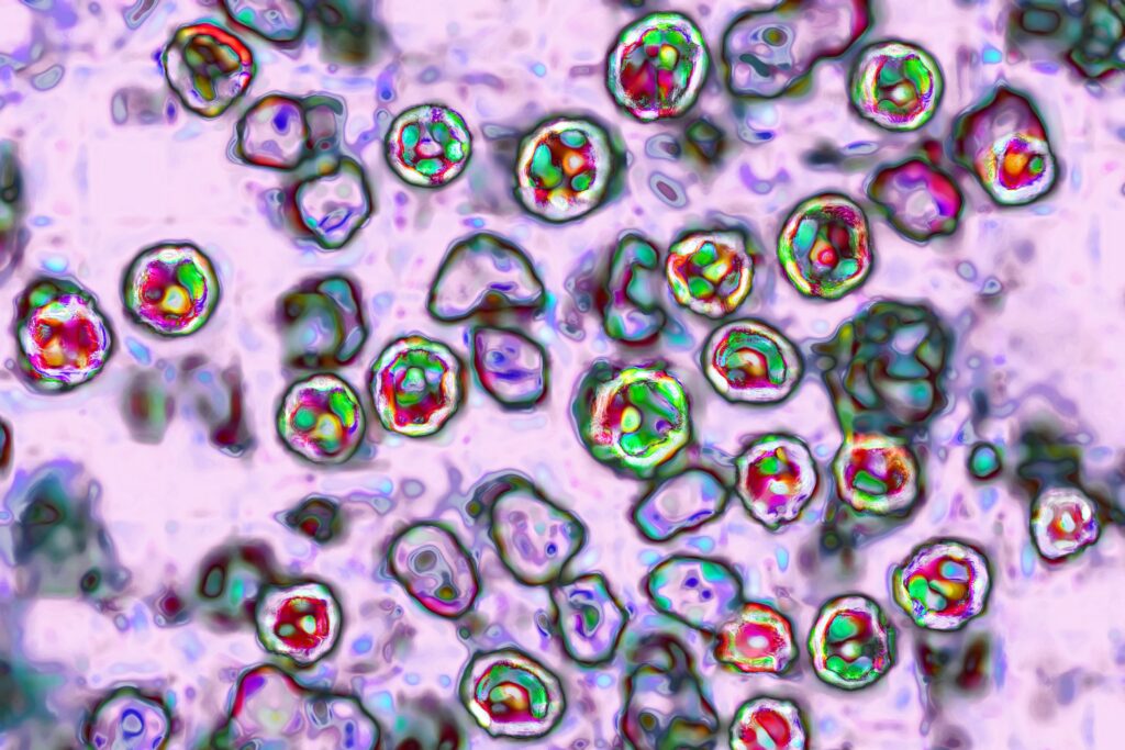 Pennsylvania measles outbreak is first in 35 years to top 1,000 cases