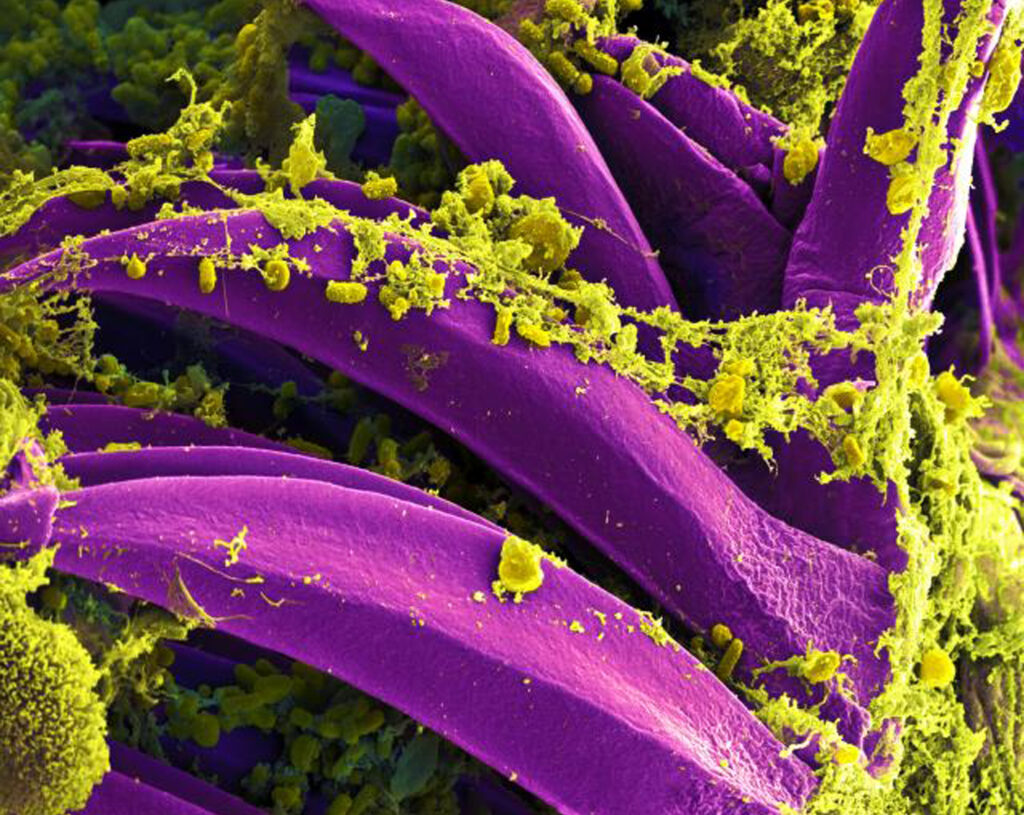 What is pneumonic plague, and how will we know if it’s spreading in Russia?