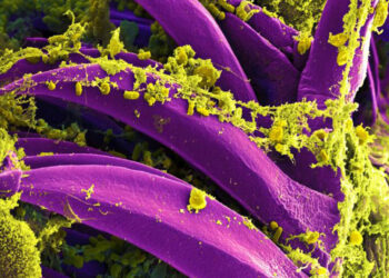 What is pneumonic plague, and how will we know if it’s spreading in Russia?
