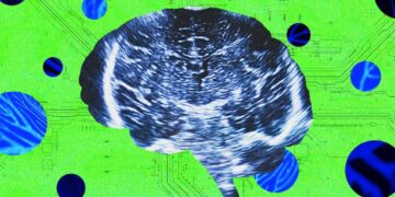 A New Neurotech Startup Launches to Rival Sam Altman’s Merge Labs