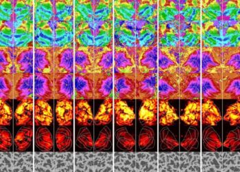 New AI Can Figure Out What You’re Thinking About From a Brain Scan