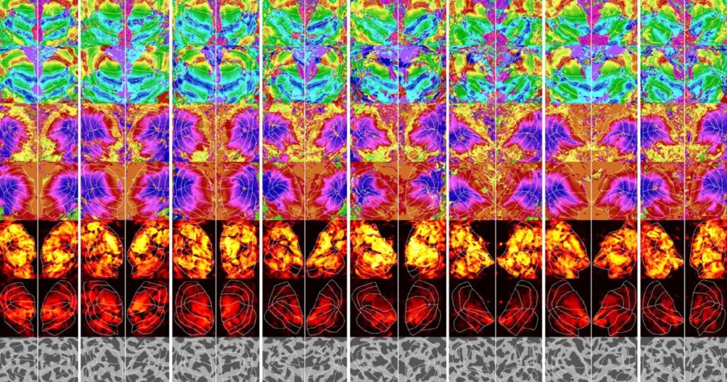 New AI Can Figure Out What You’re Thinking About From a Brain Scan