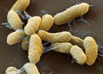 What Experts Want to Know About the Russia Plague Scare