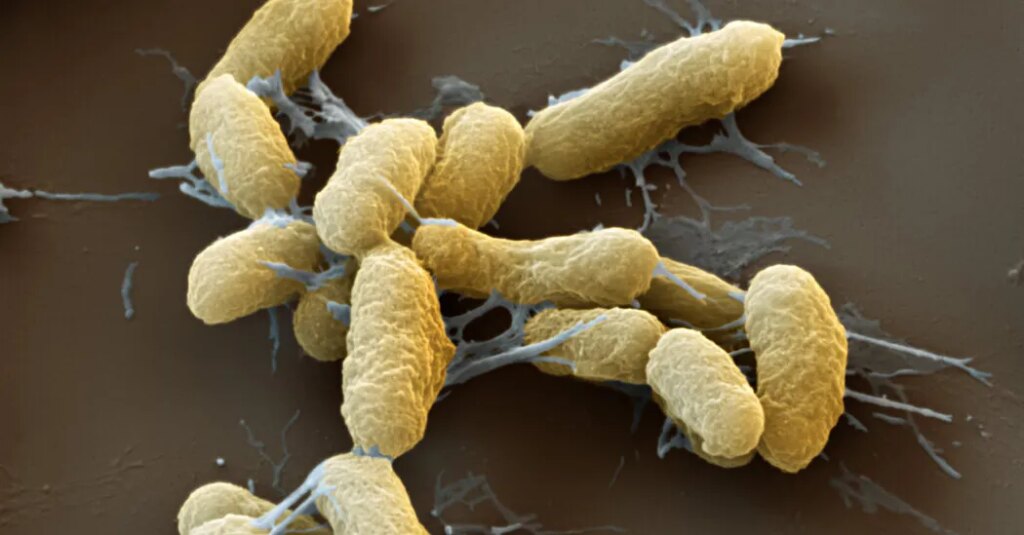 What Experts Want to Know About the Russia Plague Scare