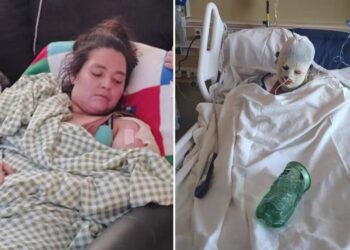 Family begs for justice after woman set on fire at California homeless camp dies