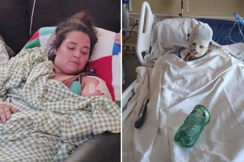 Family begs for justice after woman set on fire at California homeless camp dies