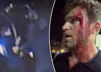 Bloodied ‘Pretty Little Liars’ star Keegan Allen robbed at gunpoint, knifepoint in attack outside luxury Hollywood grocery store