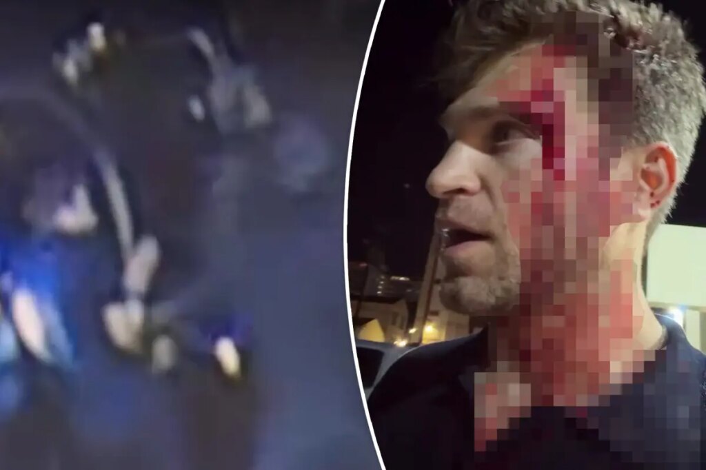 Bloodied ‘Pretty Little Liars’ star Keegan Allen robbed at gunpoint, knifepoint in attack outside luxury Hollywood grocery store