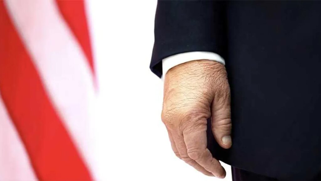 Trump’s health issues once again on full display during award ceremony