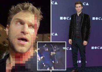 ‘Pretty Little Liars’ star pistol-whipped in terrifying West Hollywood robbery calls out Karen Bass, Gavin Newsom after attack