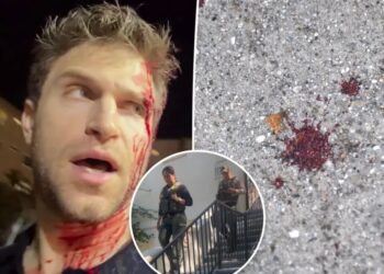 Watch deputies leave Keegan Allen’s home as investigation continues into bloody grocery store attack
