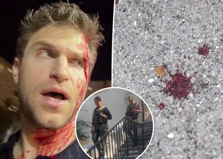 Watch deputies leave Keegan Allen’s home as investigation continues into bloody grocery store attack