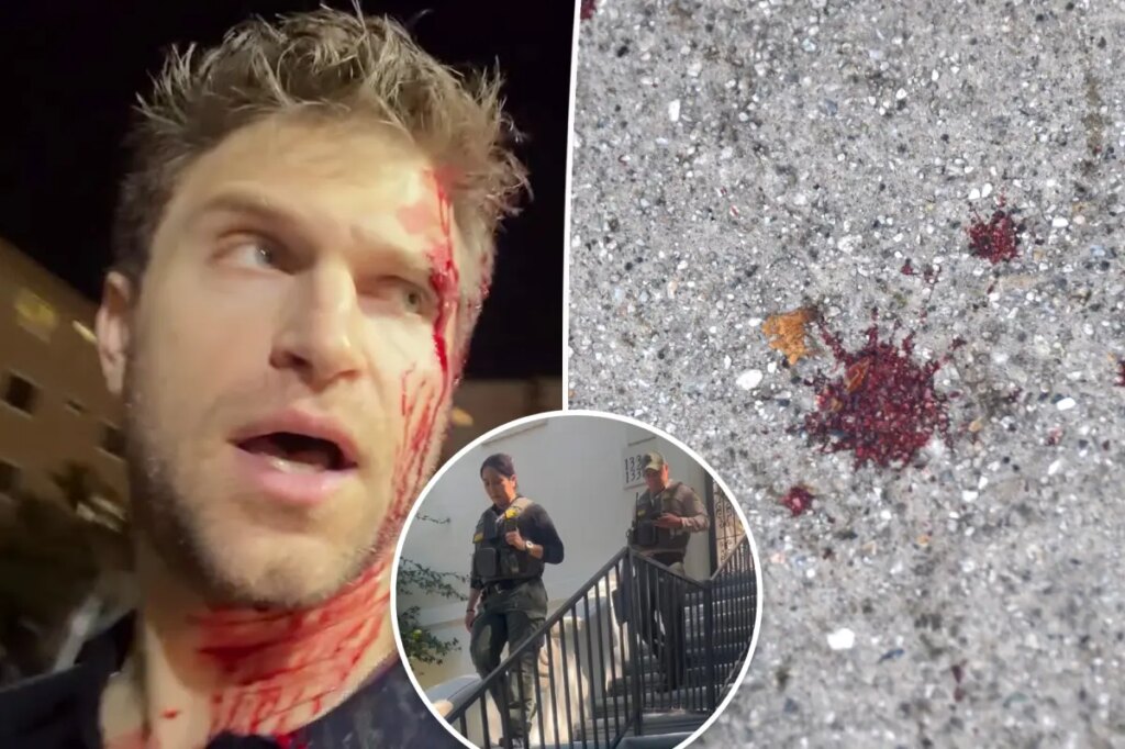 Watch deputies leave Keegan Allen’s home as investigation continues into bloody grocery store attack