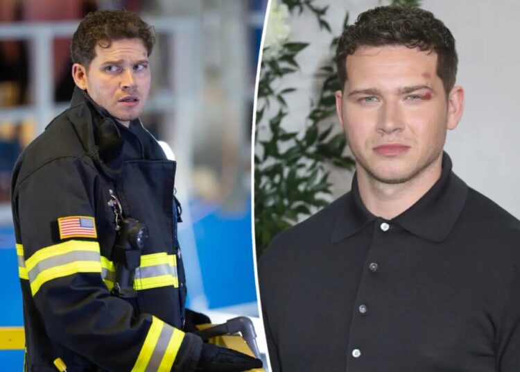 ‘9-1-1’ star Oliver Stark and 3 others suffer stunt-related injuries on set