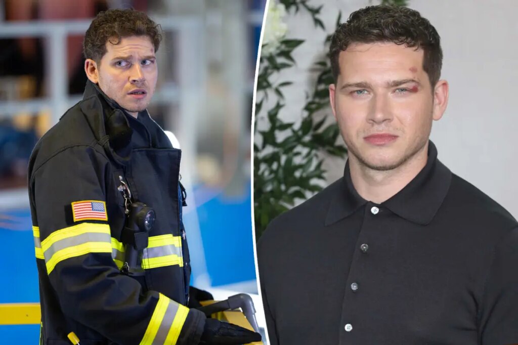 ‘9-1-1’ star Oliver Stark and 3 others suffer stunt-related injuries on set