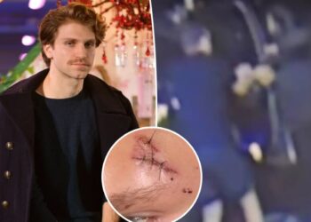 ‘Pretty Little Liars’ star Keegan Allen shows off battered, stitched-up face after brutal attack in LA