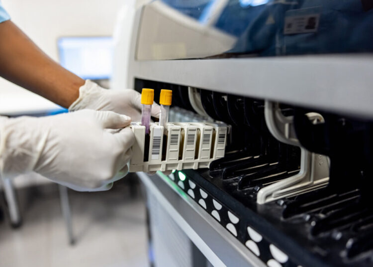 Why doctors are urging women to redo early genetic tests for cancer risks