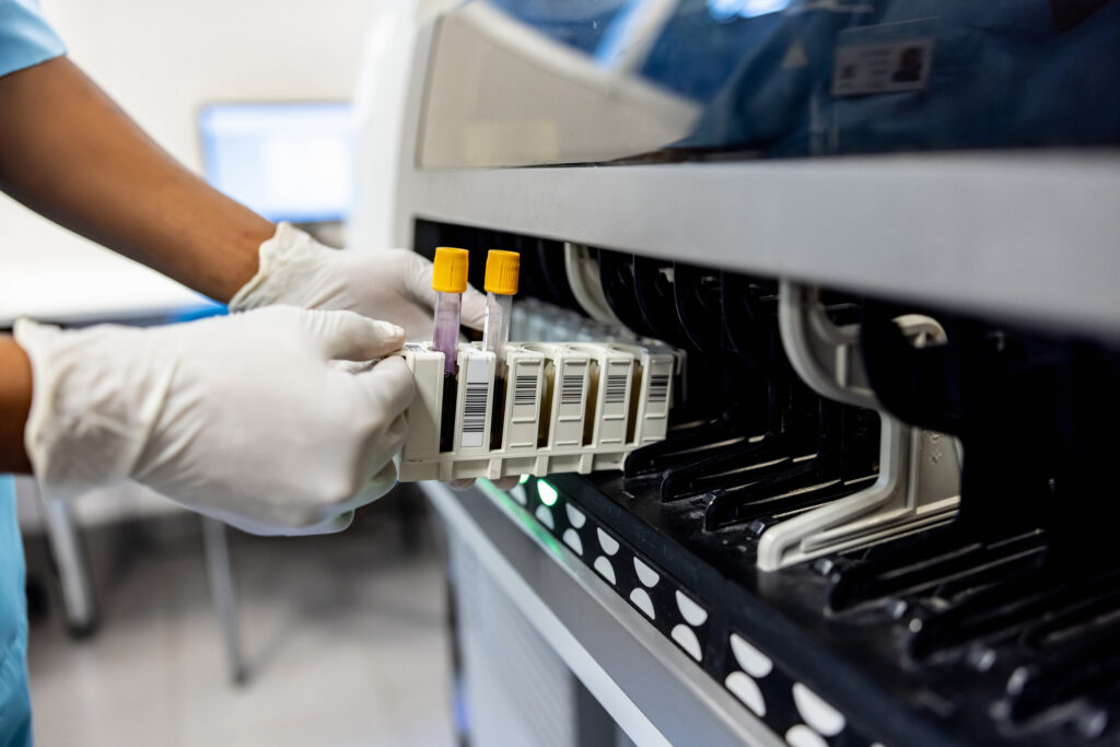 Why doctors are urging women to redo early genetic tests for cancer risks