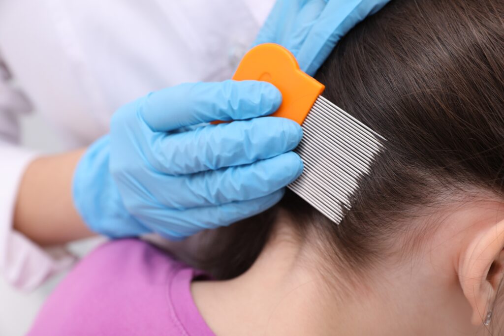 I’m a primary care doctor and a parent. Here’s how I handle lice.