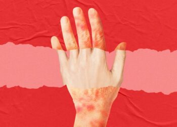 A New Anti-Aging Drug Looks to Turn Back the Clock on Skin Age