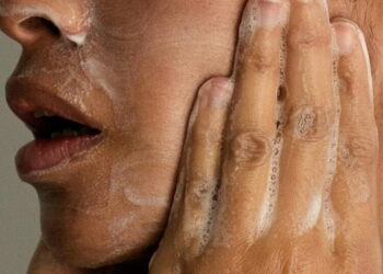 Adult acne is real, but there are ways to treat it. Here’s what to know