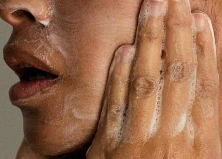 Adult acne is real, but there are ways to treat it. Here’s what to know