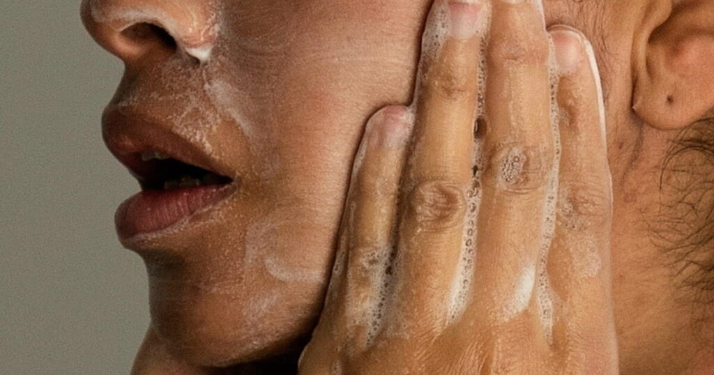 Adult acne is real, but there are ways to treat it. Here’s what to know