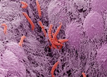 These common infections can cause cancer. Here’s what can lower your risk.