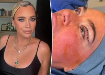 Teddi Mellencamp defends undergoing plastic surgery procedure during stage 4 cancer treatment