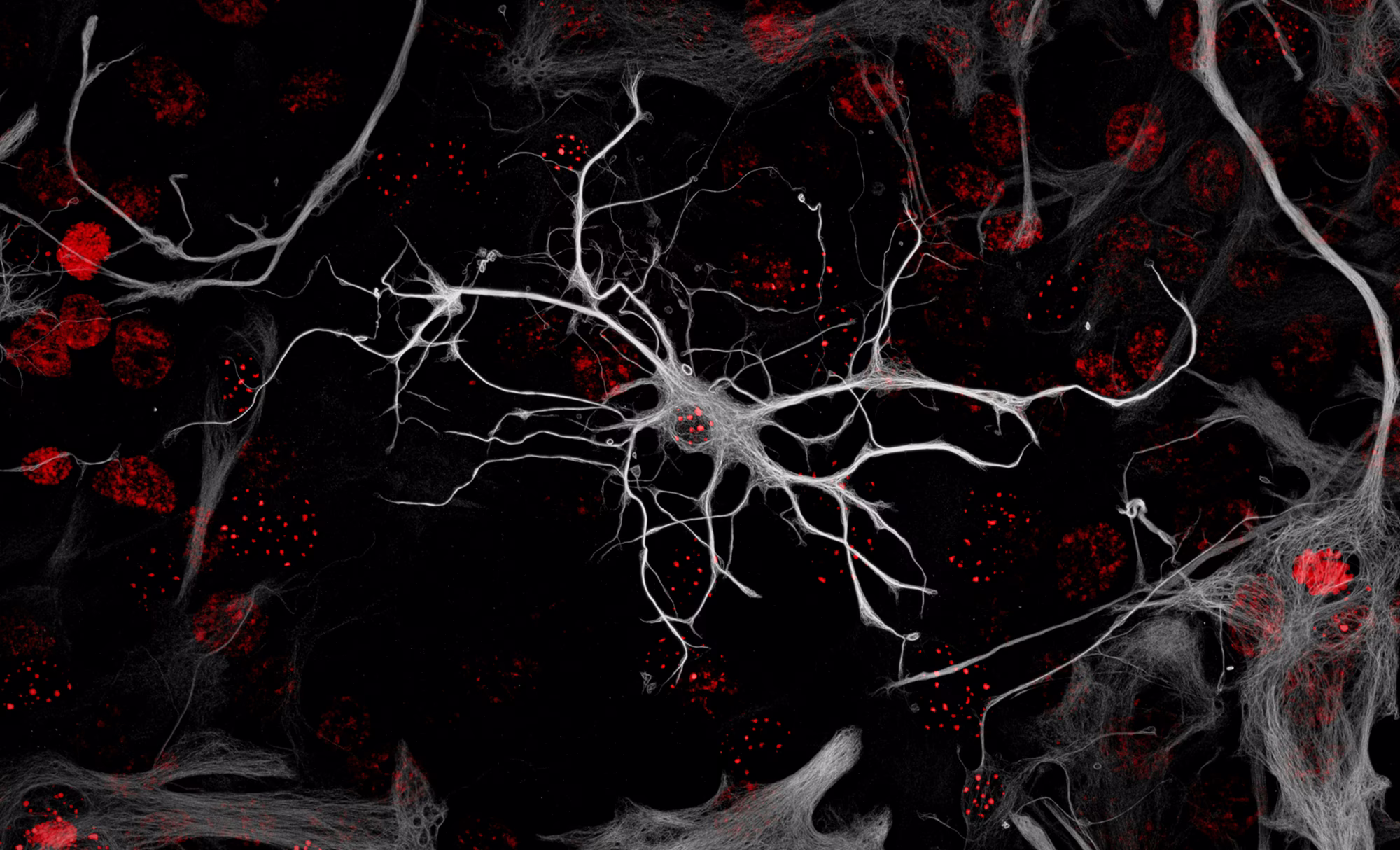 A. black-white-and-red microscopic image of a many-tendriled cell