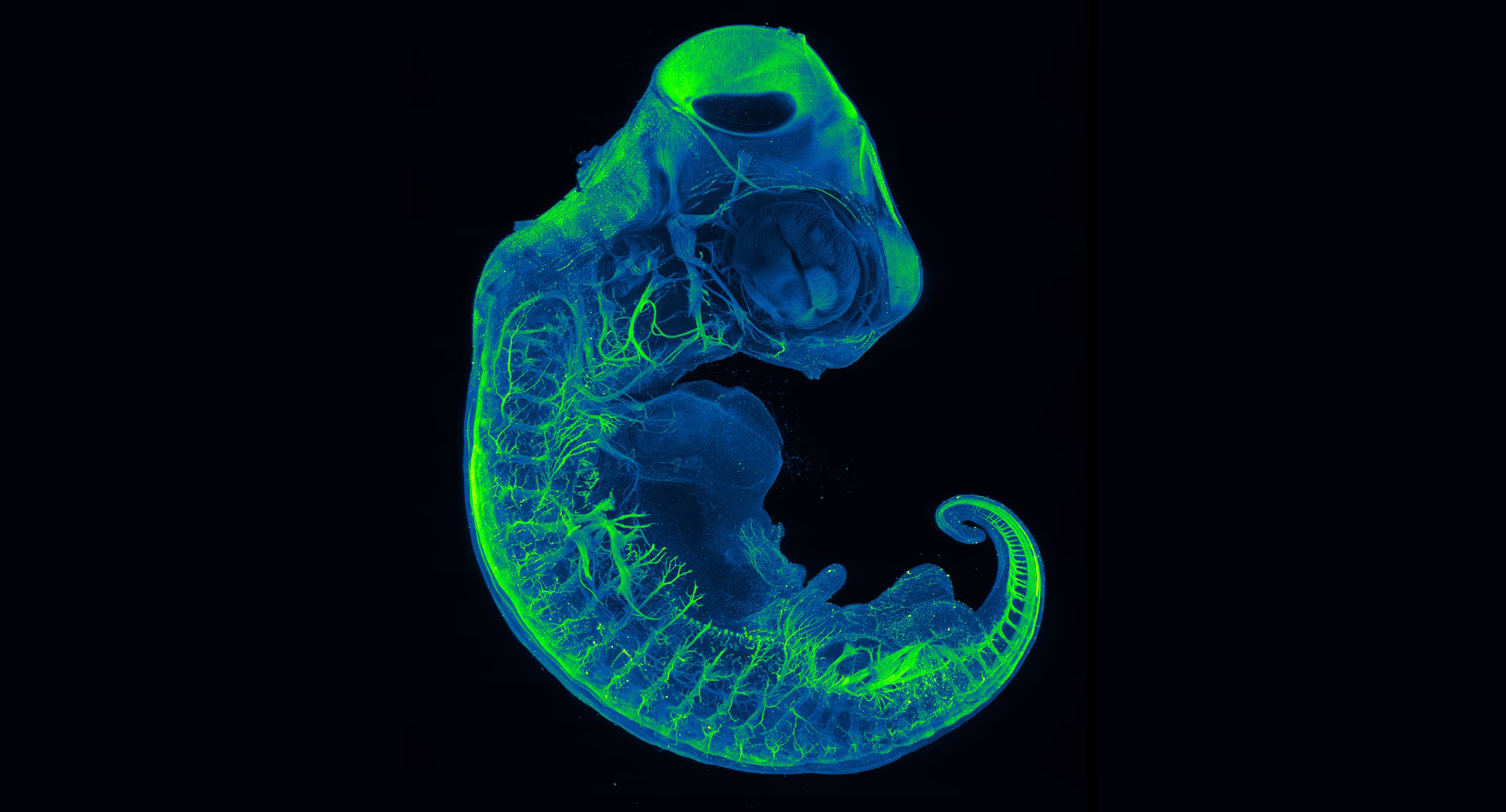 A microscopic image of a turtle embryo, with neural pathways colored bright green