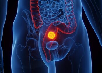 Some Rectal Cancer Patients May Be Able to Skip Surgery, Chemo, and Radiation