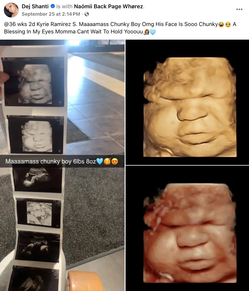 A Facebook post shared by Angelina Stone about her unborn baby Kyrie on Sept. 25, 2026, is shown. 