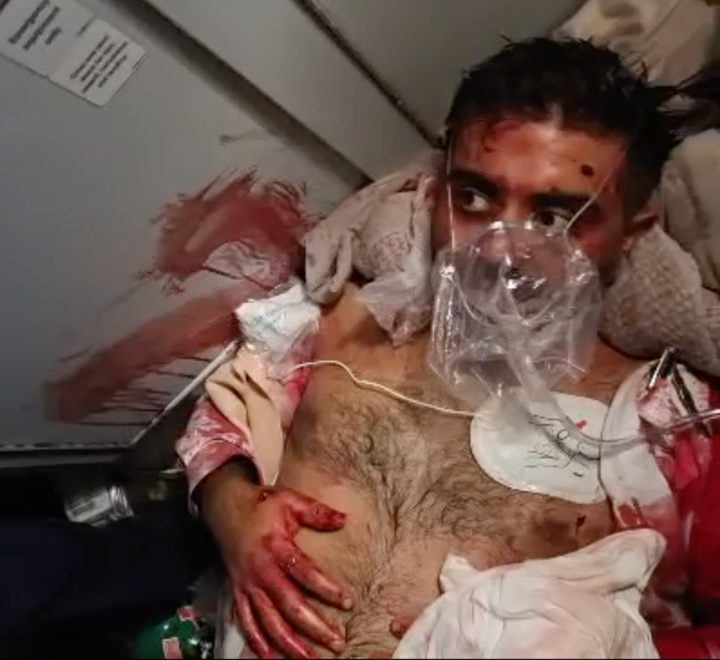 FlyDubai Captain Smit Machchhar, injured and wearing an oxygen mask, with blood on his hands and shirt in an airplane.