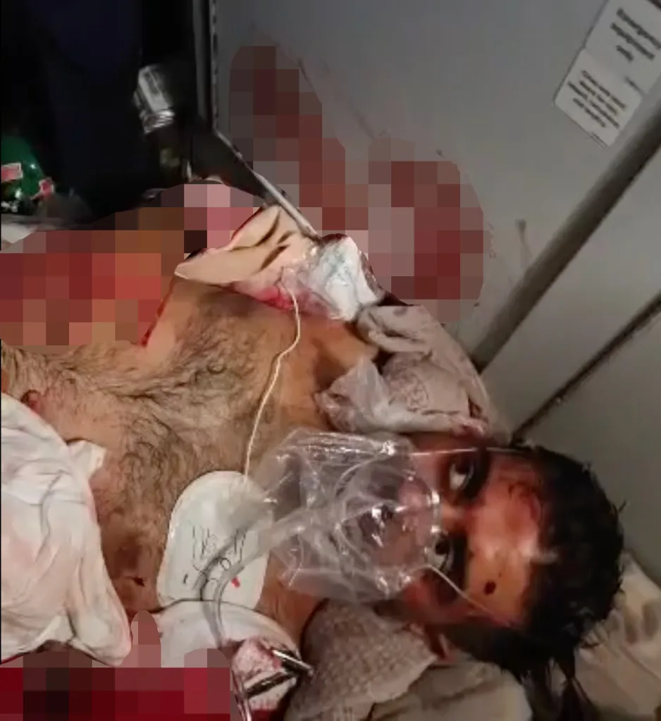 FlyDubai Captain Smit Machchhar lying injured and receiving medical attention following a stabbing attack.