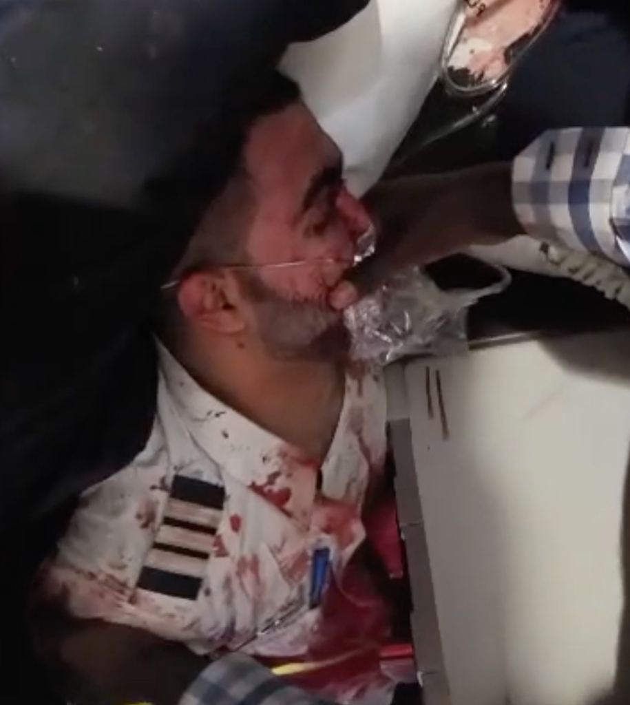 An injured and bound co-pilot in a bloodied uniform on a FlyDubai flight.