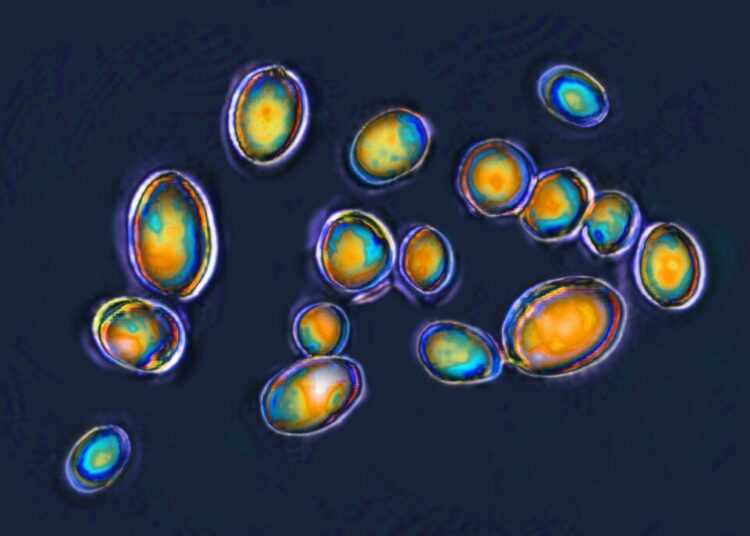 These superbugs pose the biggest threat to Americans, CDC says