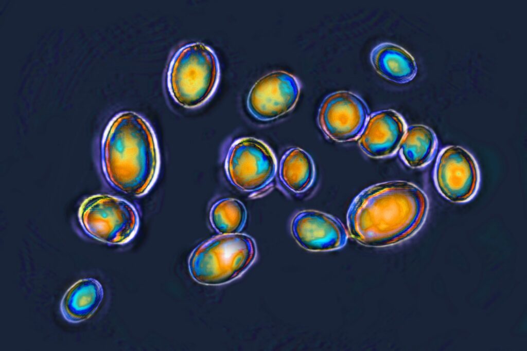 These superbugs pose the biggest threat to Americans, CDC says