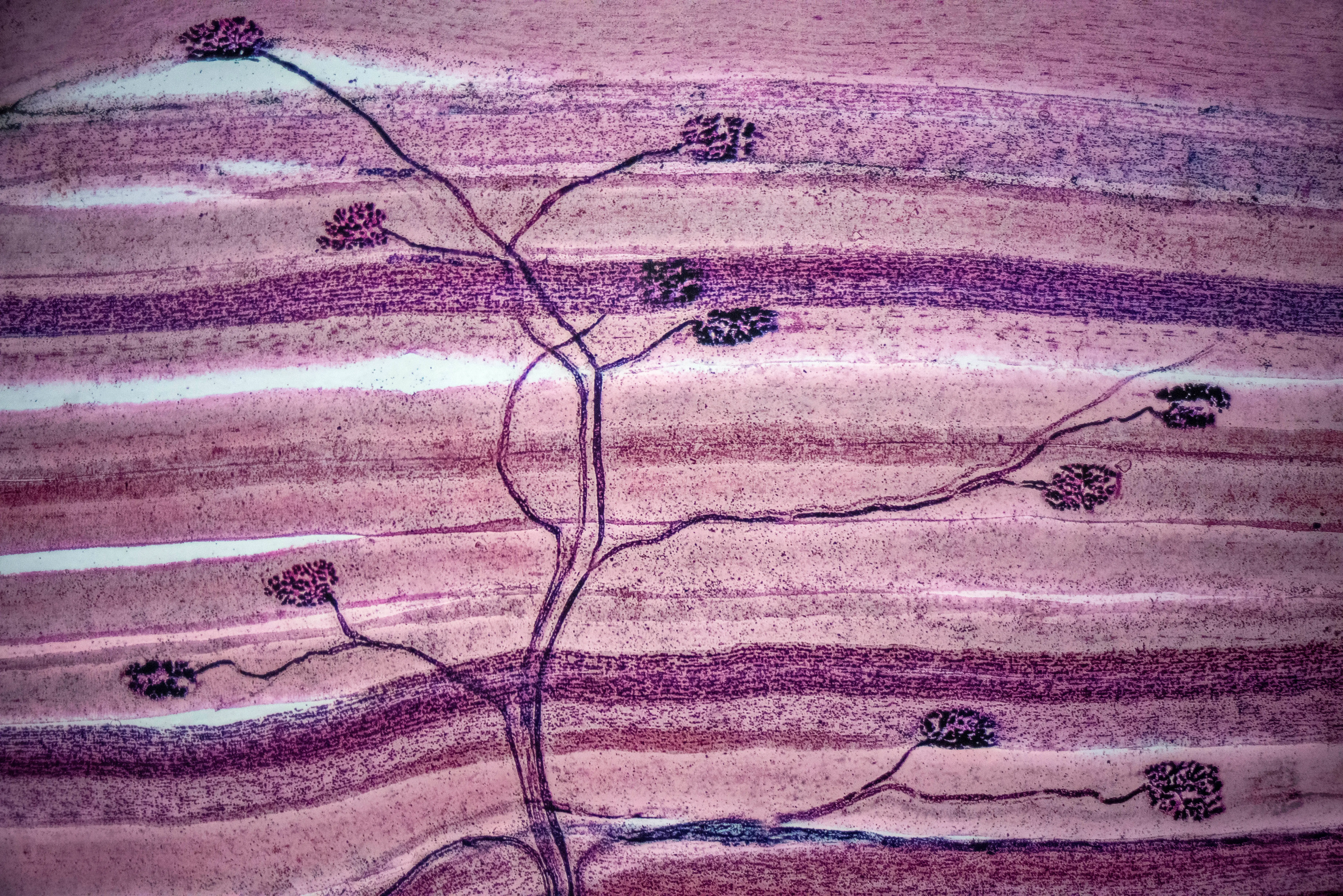 An illustration of motor neuron synapsing with skeletan muscle cells.
