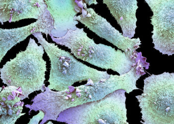 Beyond cigarettes: Uncovering the causes of lung cancer in nonsmokers