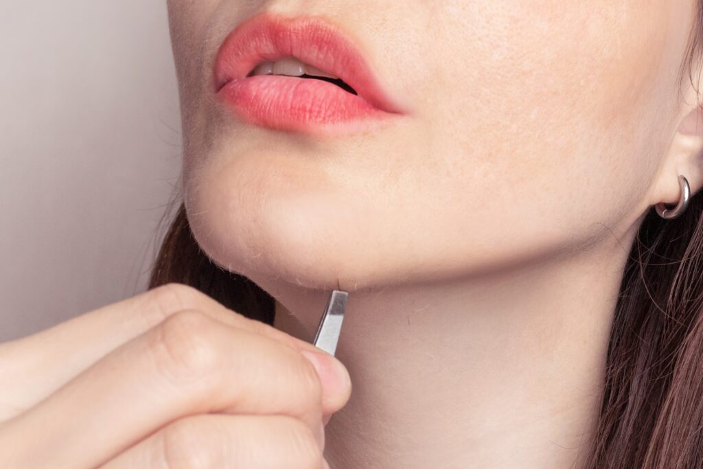 What causes random chin hairs and what to do about them